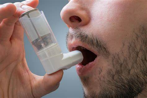 Covid, l’esperto: “L’asma allergico sembra essere ‘protettivo’ rispetto allo sviluppo di polmonite grave”
